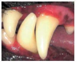 Dents après l’intervention