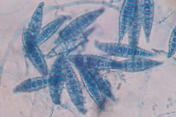 Microsporum canis 2