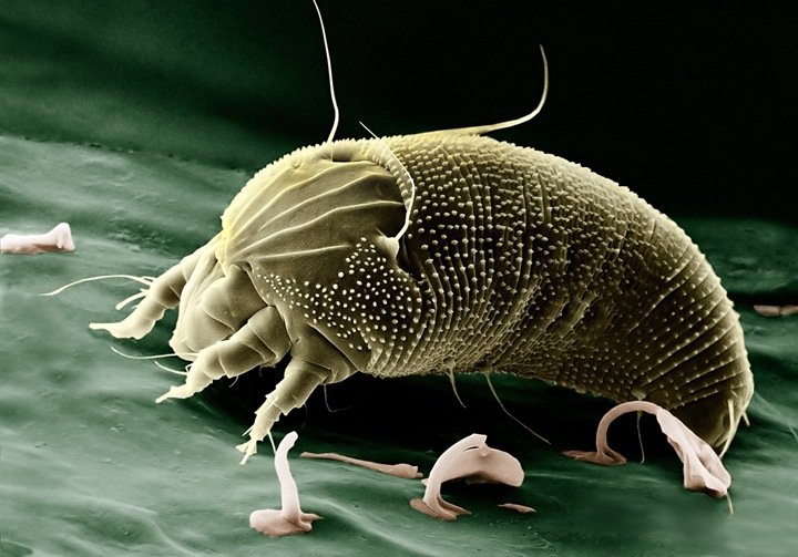Les acariens figurent parmi les allergènes